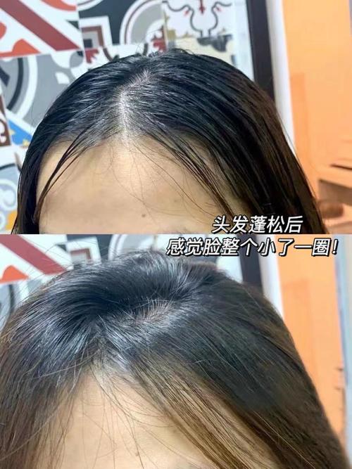 今晚开奖结果号码和因发量太多剃掉头发与因发量太多剃掉头发会怎么样